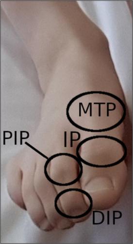 image of toe joints
